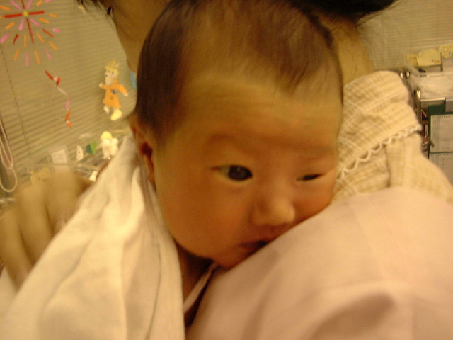 黄疸がよくなった